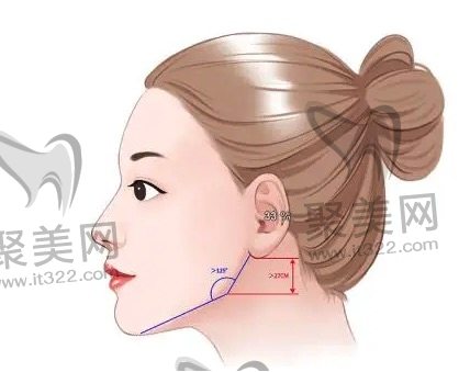 下颌角切除需要多少钱 下颌角切除需要多少钱