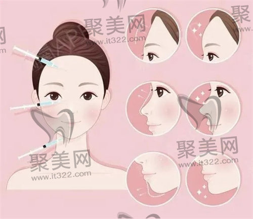 面部填充 面部填充