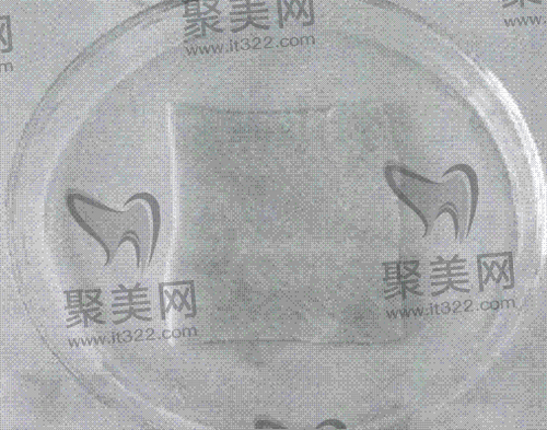 adm真皮基质 adm真皮基质