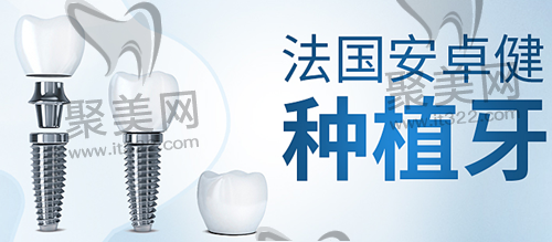法国安卓健种植体 法国安卓健种植体