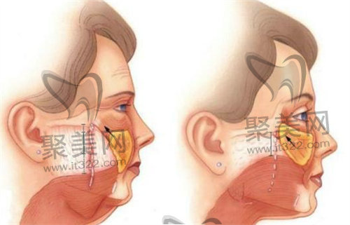 黄广香医生怎么预约? 黄广香医生怎么预约?