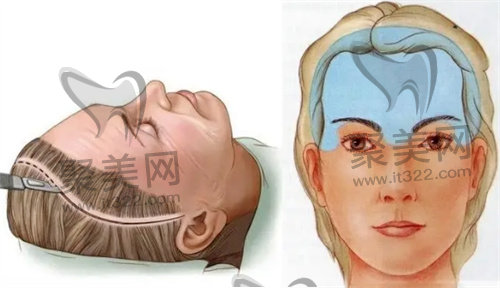 黄广香医生怎么预约? 黄广香医生怎么预约?