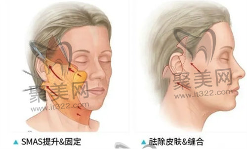 黄广香医生怎么预约? 黄广香医生怎么预约?