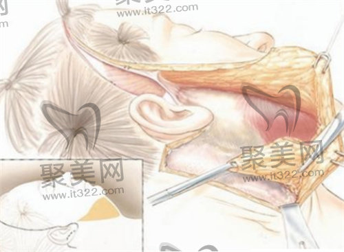 黄广香医生怎么预约? 黄广香医生怎么预约?