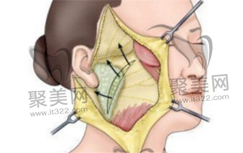 黄广香医生怎么预约? 黄广香医生怎么预约?