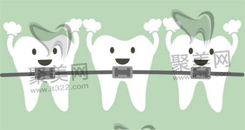 牙齿正畸 牙齿正畸