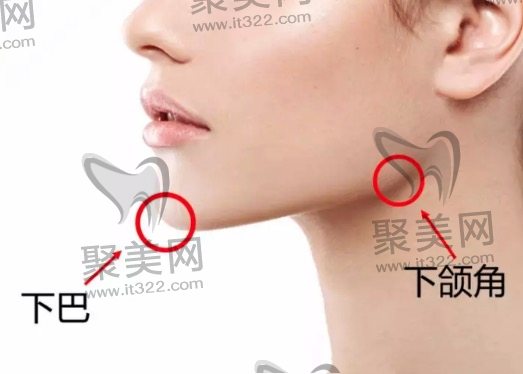 颧骨内推和下颌角一共花5万元算贵吗? 颧骨内推和下颌角一共花5万元算贵吗?