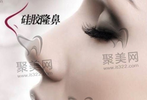 硅胶隆鼻多少钱 硅胶隆鼻多少钱