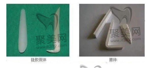 膨体隆鼻收费价格贵不贵? 膨体隆鼻收费价格贵不贵?