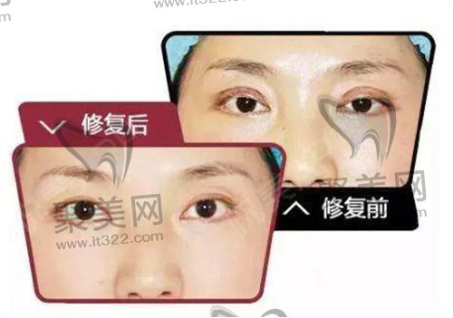 1682221556832546.jpg 3b0cc7c64fe38c63de58ead047623cab_180822153914_21419d.jpg