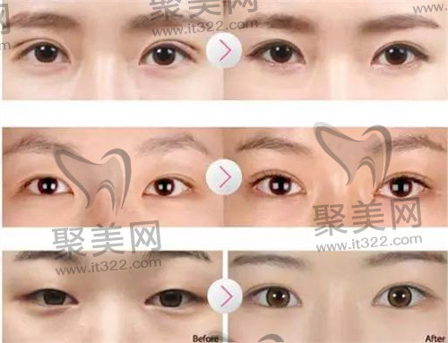 1682221559170335.jpg 2f278489139efa73c0538e07ff3ae36f_ff500220d5764a36a9203706a90d1fb5_th.jpg