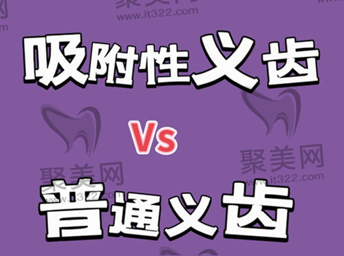 吸附性义齿 吸附性义齿