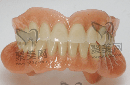 吸附性义齿 吸附性义齿