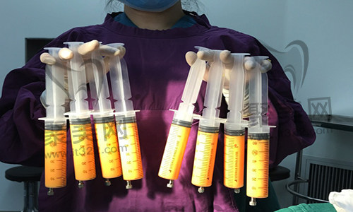 腰腹吸脂 腰腹吸脂