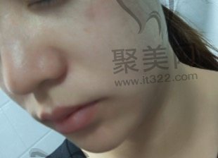 佛山顺德大良广大医疗美容皮肤项目 佛山顺德大良广大医疗美容皮肤项目