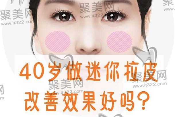 面部拉皮适合哪个年龄段? 面部拉皮适合哪个年龄段?