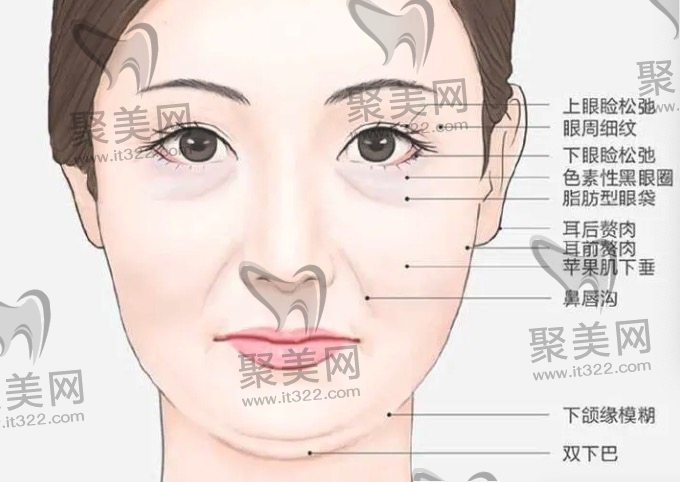 面部松弛怎么样改善 面部松弛怎么样改善