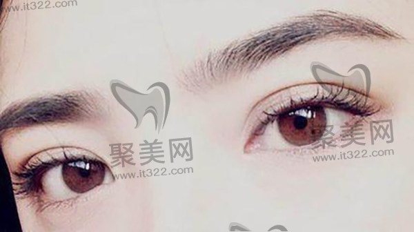 郑州葛艳娜做双眼皮口碑评价 郑州葛艳娜做双眼皮口碑评价