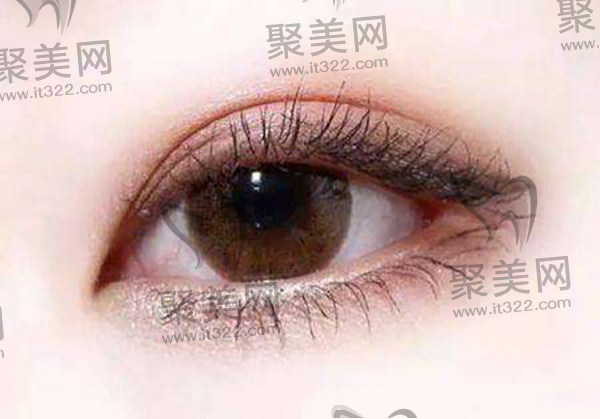 河南中医药大学葛艳娜双眼皮多少钱 河南中医药大学葛艳娜双眼皮多少钱