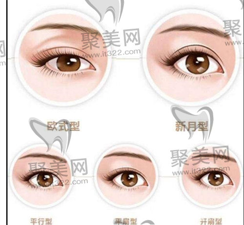 双眼皮 双眼皮