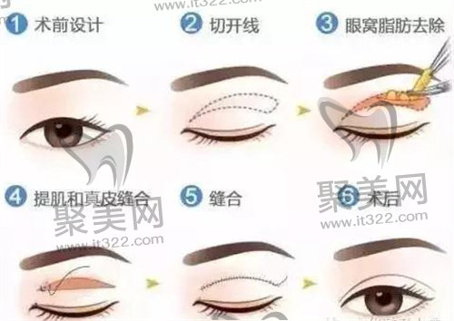 1682487372417435.jpg e01615e3db92d8cf3f1d9407bbf6f4f1_15253970971299.jpg