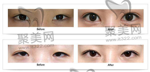 1682487381308273.jpg 6cfce32566d0c83c6dcdb62f272558ac_1463476466798510.jpg