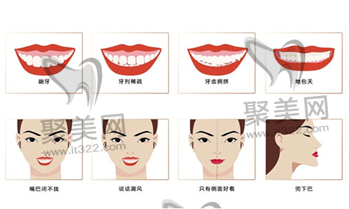 歪牙矫正 歪牙矫正