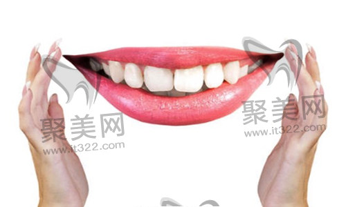 歪牙矫正 歪牙矫正