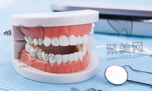 歪牙矫正 歪牙矫正