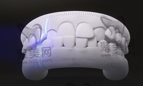 歪牙矫正 歪牙矫正