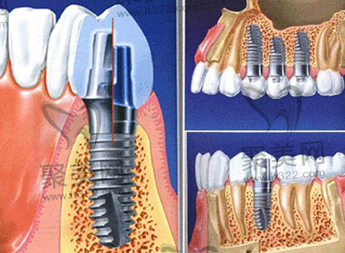 1682495655197060.jpg 5.jpg