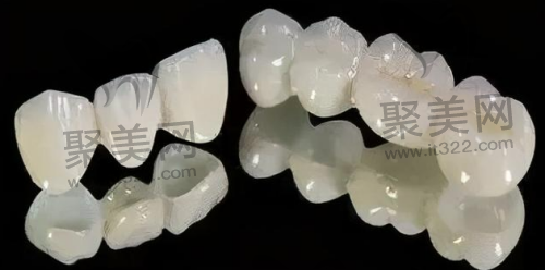 全瓷牙的优缺点 全瓷牙的优缺点