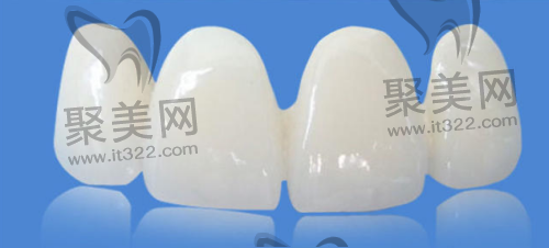 全瓷牙品牌不同价格有差距 全瓷牙品牌不同价格有差距