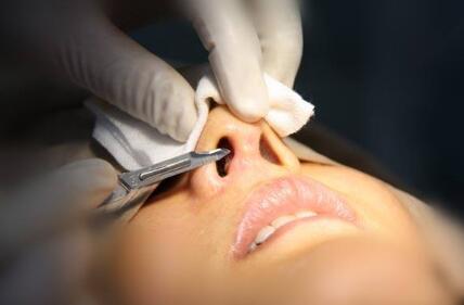 广州的整形需要多少钱呀?隆鼻整形价格?