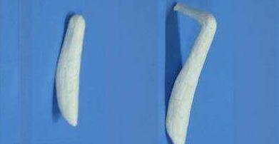 如何选择假体隆鼻专家?应该如何选择?