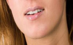 脂肪填充下巴会有什么不好的后果？风险大吗？