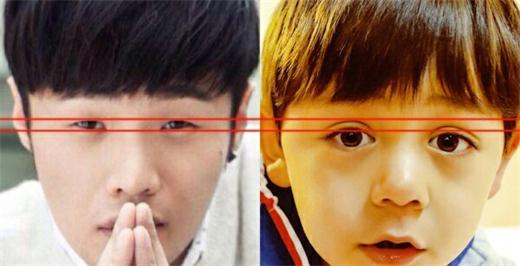 为何你的眼睛不好看?这是怎么回事?|尽美整形