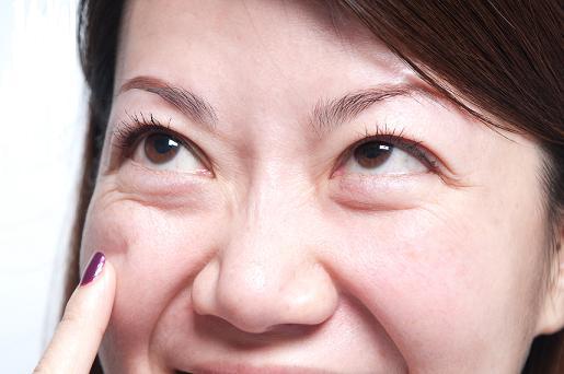 为什么要去眼袋?有哪些有*的方法?