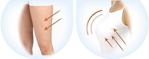 自体脂肪隆胸适合哪些人?|尽美网