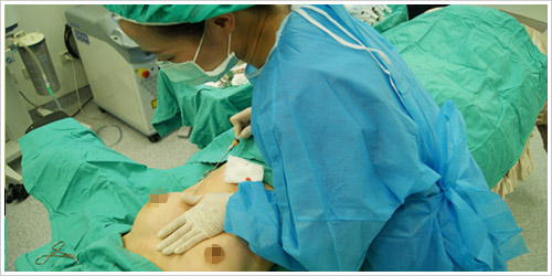 自体脂肪隆胸的优势有哪些?|尽美网