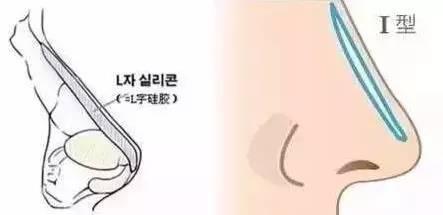 隆鼻后不能揉来揉去?