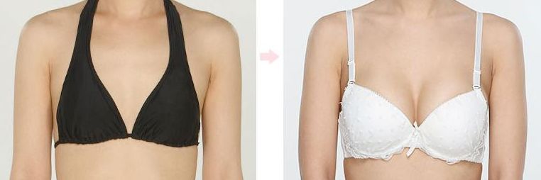 做假体隆胸好不好?能维持多久?