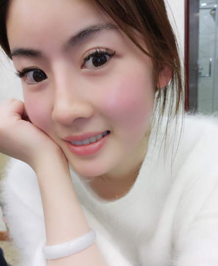 隆鼻后鼻尖会发白是怎么回事?真人案例分享