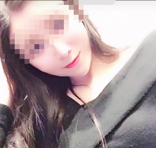 武汉爱思特做下颌角整形的价格是多少?