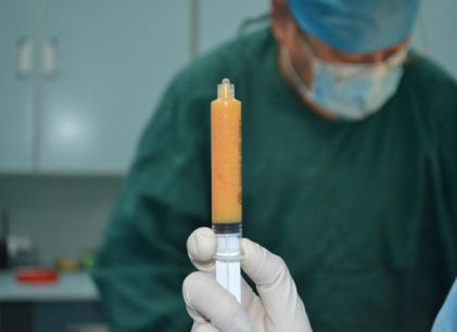 自体脂肪隆胸四大误区,比假体好?会被吸收完