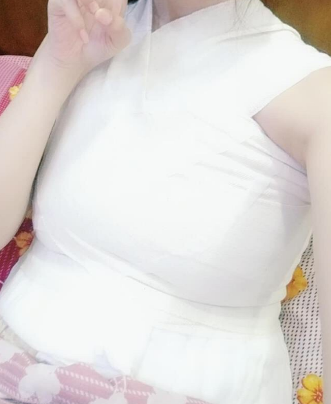 自体脂肪隆胸四大误区,比假体好?会被吸收完