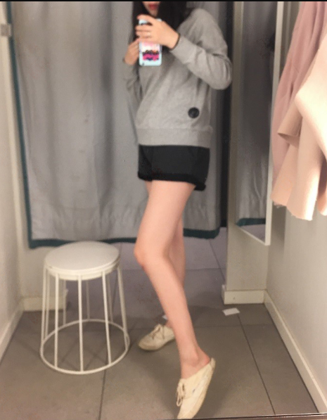 乌鲁木齐大腿吸脂80多天,小姐姐说的*果很满意