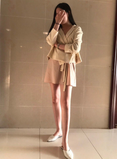 乌鲁木齐大腿吸脂80多天,小姐姐说的*果很满意