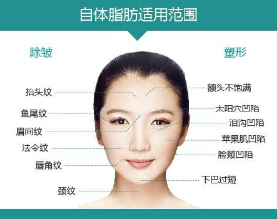 成都自体脂肪填充医院医生测评,分公立、私立