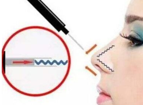 “为什么不推荐我做*?”一个打算做线